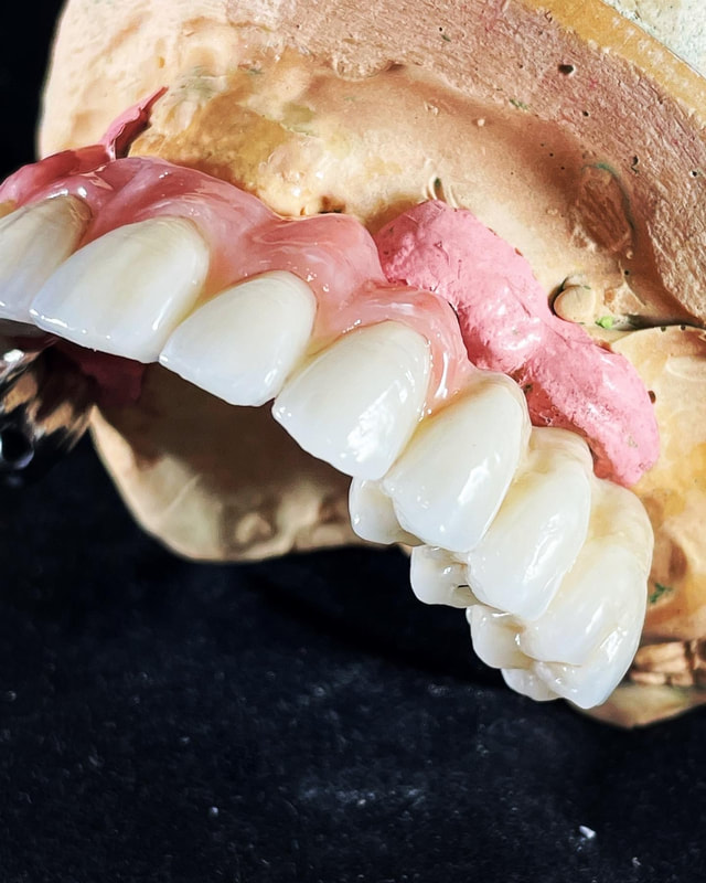 Putting final touches on trusana printed teeth