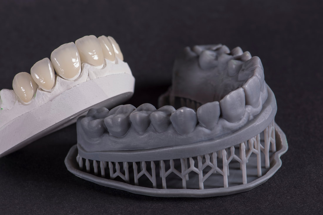 lithium disilicate dental crowns