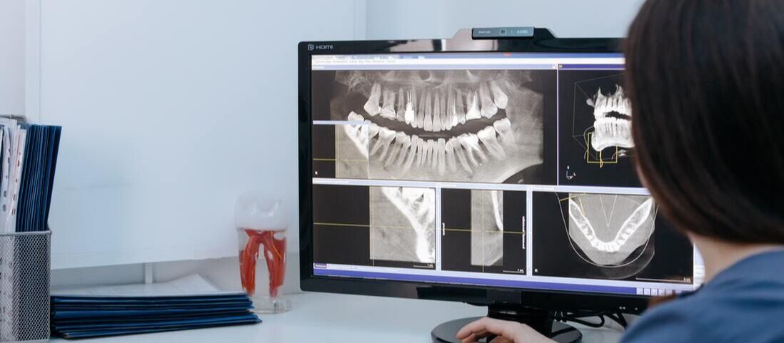 Picture of a woman looking at dental xrays