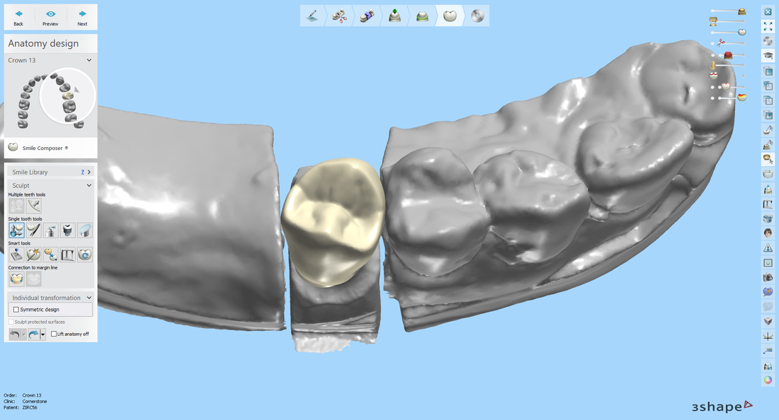 Digital dental scanner