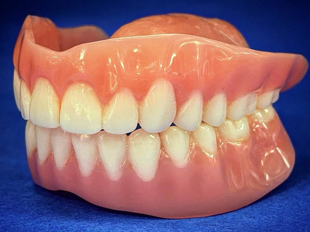 Picture of digital dentures