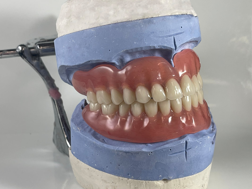 dental labs for dentures