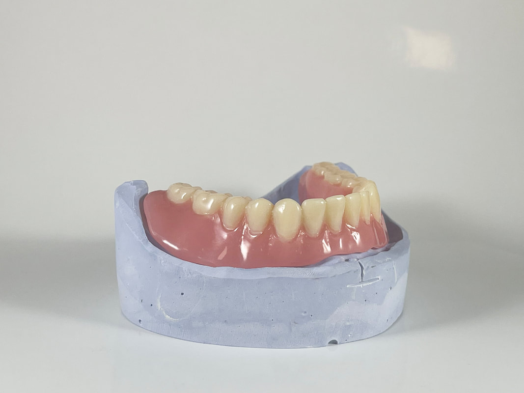 digital dentures