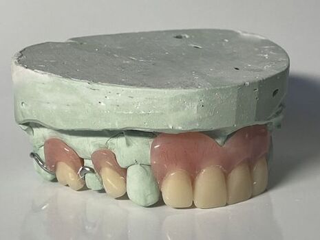 Custom Dental Lab