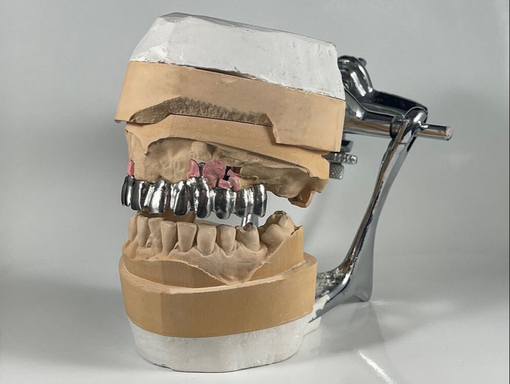 chrome cobalt dental alloy
