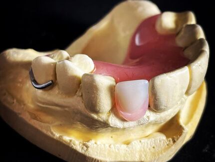 Denture Teeth Repair & Broken Denture Tooth Repair | Denture Repair Lab