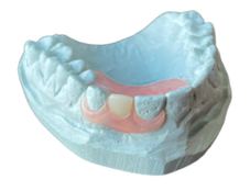 Picture of valplast flexible denture particle