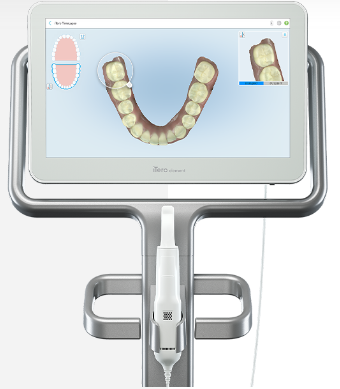 digital dental scanner