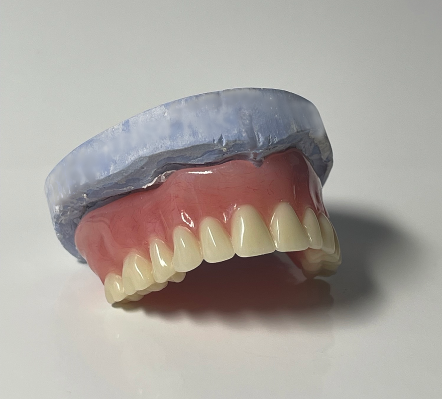 Analog vs. digital dentures