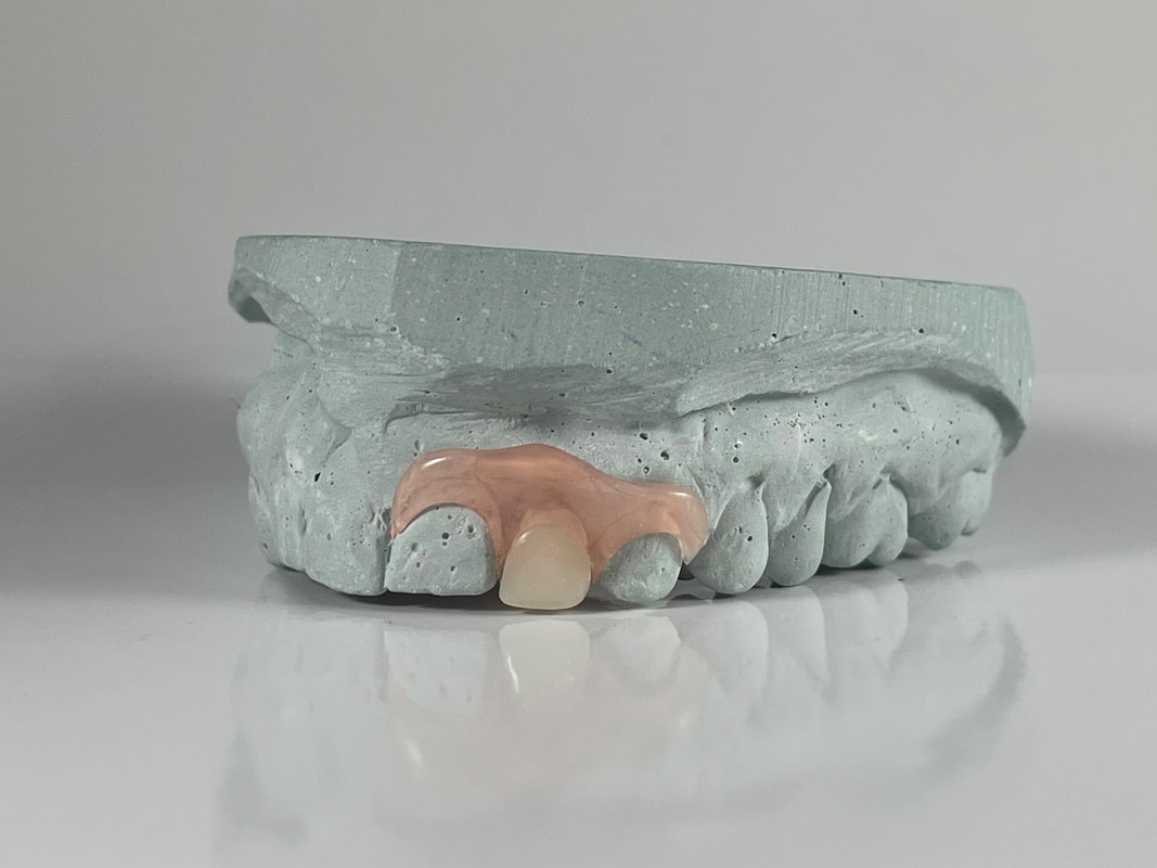Valplast Dental Nesbit