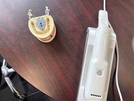 Picture of a mouth model and the iTero Element intraoral scanner