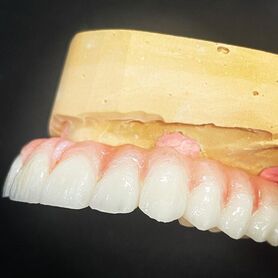 Picture of trusana printed teeth