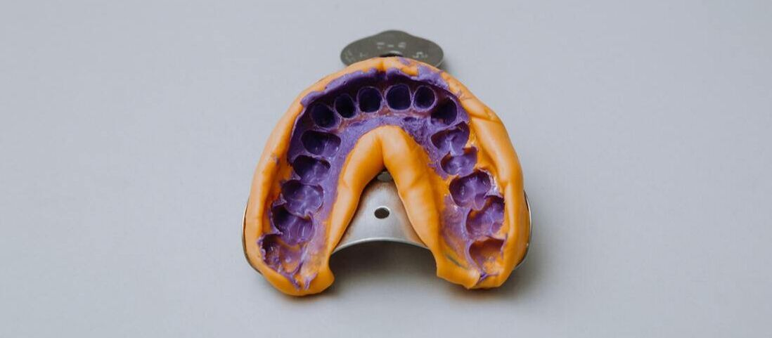 Picture of a dental impression