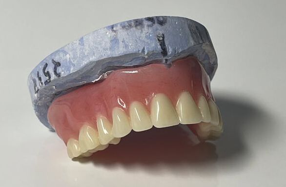 full arch dentures