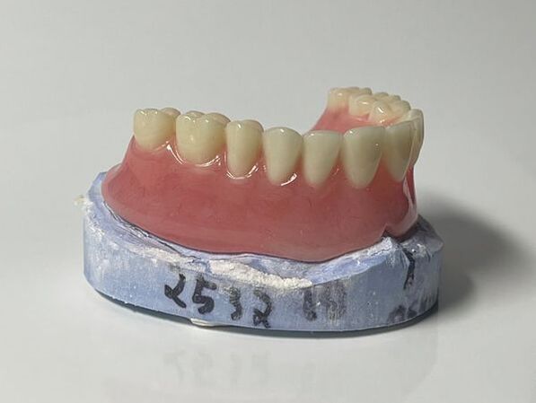 Analog vs. digital dentures