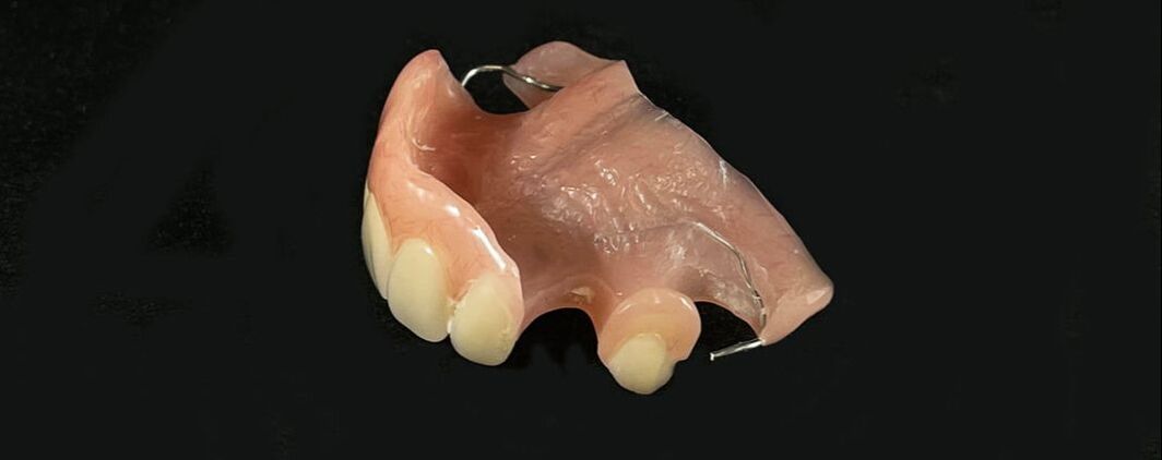 Acrylic partial dentures