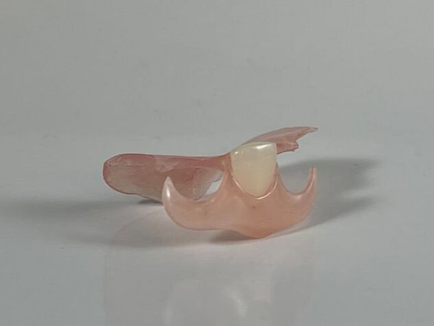 valplast dental nesbit partial flexible denture
