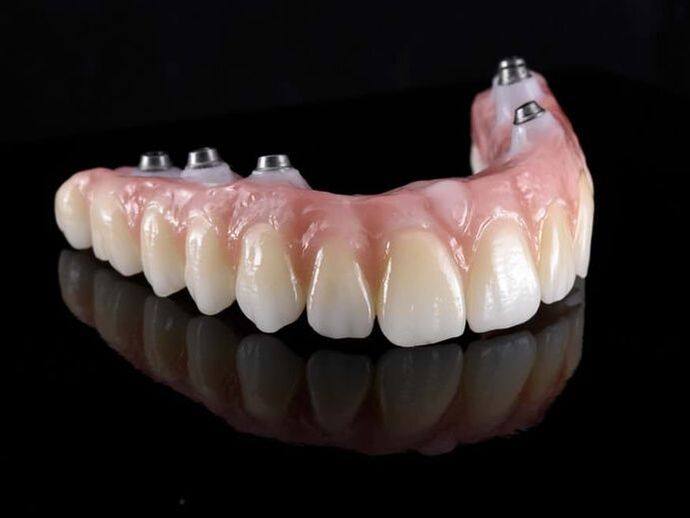 Picture of a implant on a model
