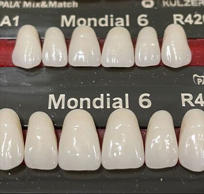 Picture of mondial teeth
