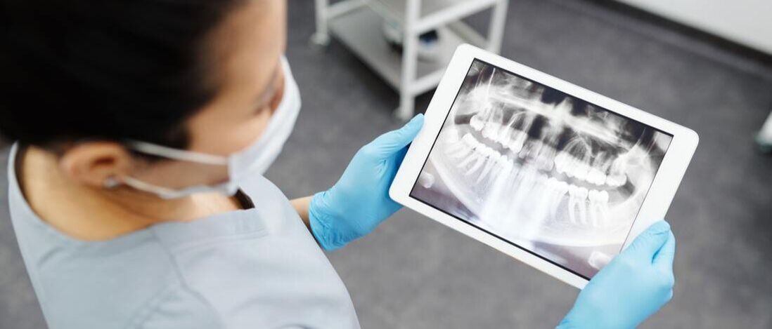 Picture of a dentist viewing a dental x-ray