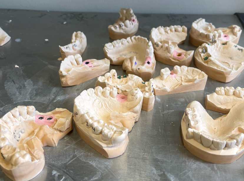 dental models