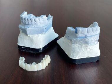 acrylic pmma teeth