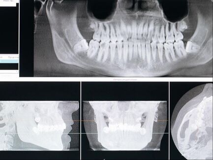 Picture of a dental x-ray