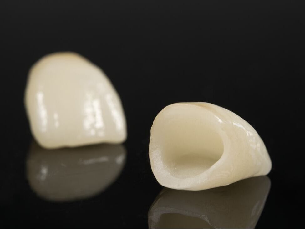 screw-retained dentures